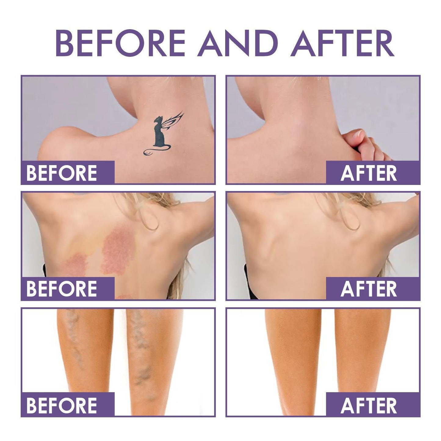 💜Sista dagen – Köp 1, få 1 gratis!💜✨Body Coverage Perfector – Vattentät, lätt och felfri kroppssmink