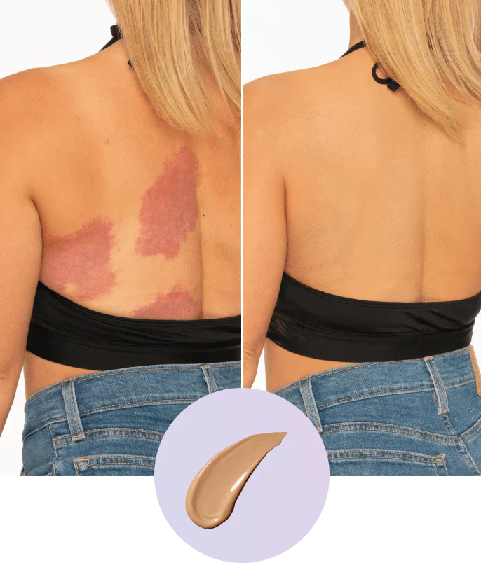 💜Sista dagen – Köp 1, få 1 gratis!💜✨Body Coverage Perfector – Vattentät, lätt och felfri kroppssmink