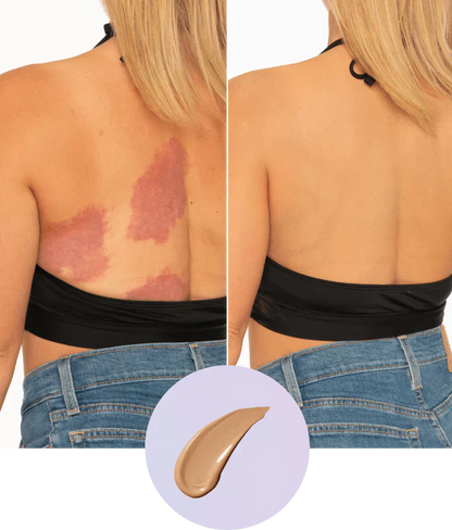 💜Sista dagen – Köp 1, få 1 gratis!💜✨Body Coverage Perfector – Vattentät, lätt och felfri kroppssmink