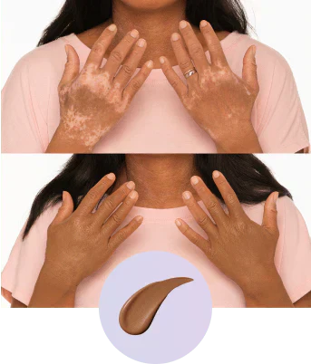 💜Sista dagen – Köp 1, få 1 gratis!💜✨Body Coverage Perfector – Vattentät, lätt och felfri kroppssmink