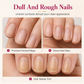 🔥50% RABATT NU! Naturlig nagelräckfyllare, jämnar ut nagelräckor snabbt 💅✨🧴✅💥